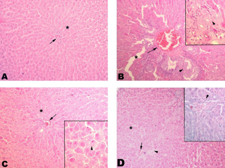 Liver histopathology. (A) Control group. Control group with proper sinusoids (*) and central vein (arrow); (B) BDL group. Significant dilatation (*) and fibrosis (arrowhead) of sinusoids are seen. Congestion in the central vein is remarkable (arrow); (C) SPL1 group. Dilatation (*) in the sinusoids and congestion in the central vein (arrowhead) regressed. The contours of the hepatocytes are smooth (arrowhead); (D) SPL2 group. Dilatation (*) and congestion (arrow) in sinusoids regressed but still low level of fibrosis (arrowhead) is seen