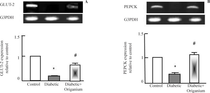 RT-PCR analysis of GLUT-2 and PEPCK expression after Origanum extract administration to type 2 diabetic Wistar rats for 2 weeks. RNA was extracted and reverse transcribed (2 μg) and RT-PCR analysis was carried for adiponectin, leptin. PARAR-γ and LPL genes. Densitometric analysis was carried for results from 5 different rats. *p<0.05 Vs control while # p<0.05 Vs diabetic group