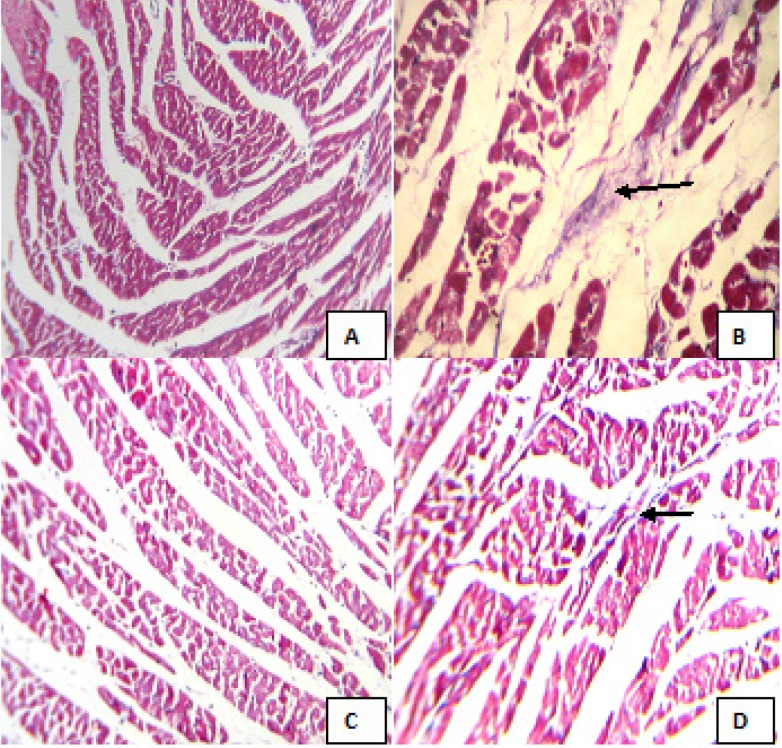Masson’s trichrome stained sections of left ventricle in different animal groups. (A) Control (Group I), (B) CEL per se (Group II), (C) BPS per se (Group III), (D) CEL+ BPS (Group IV). (Masson’s trichrome stained; 100x); CEL: Celecoxib; BPS: Beraprost Sodium. Figures A and C show normal myocardium with no collagen. Figure B shows a focal area of collagen deposition. Figure D shows normal myocardium with very less collagen deposition