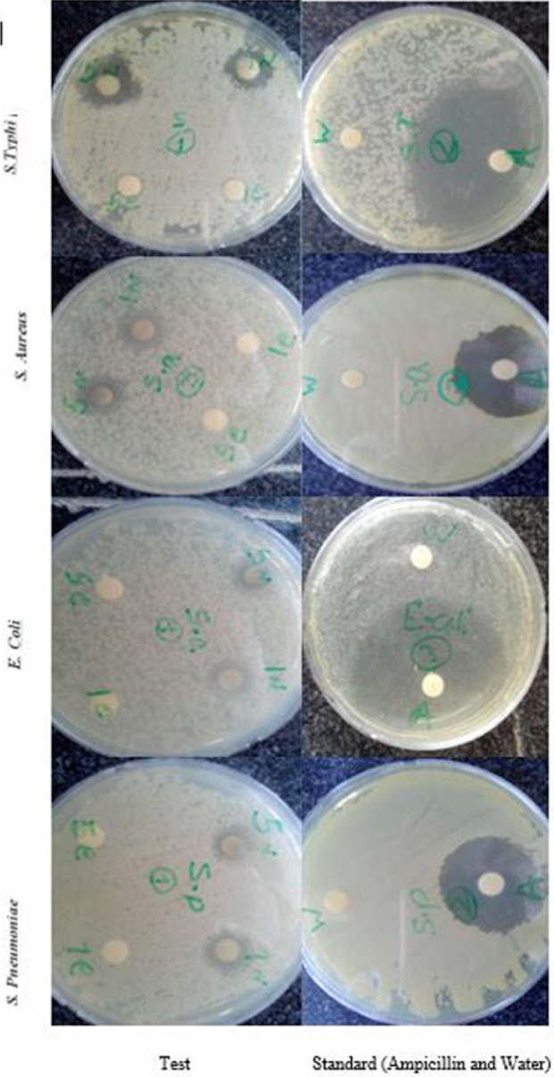 Antibacterial activity of biosynthesized Ag-NPs against human pathogens. Antibacterial effects of biosynthesized Ag-NPs evaluated by the disk diffusion method in petri plates