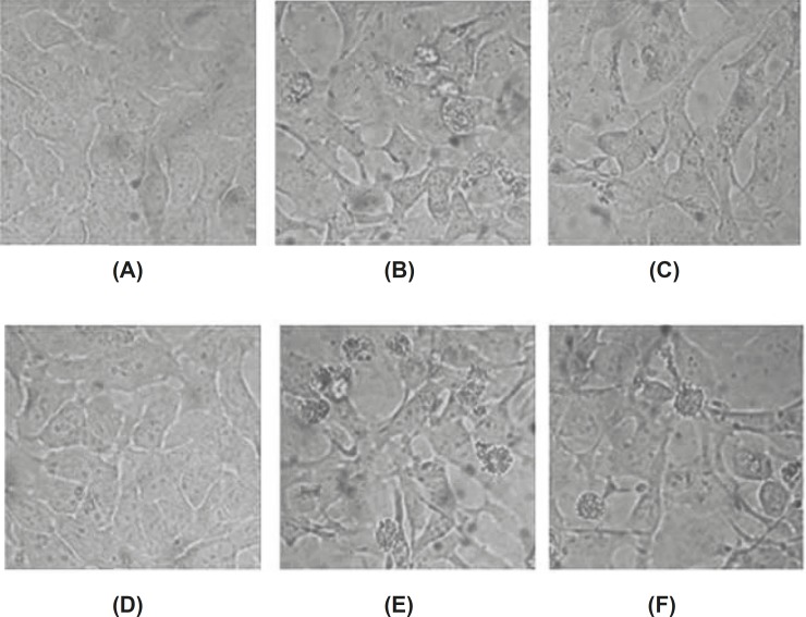 Morphological changes of apoptotic HeLa cells induced by baicalin observed under inverted microscopy (×400). (A) control group(24 h), (B) high dose group(24 h), (C) low dose group(24 h), (D) control group(48 h), (E) high dose group(48 h), (F) low dose group(48 h).