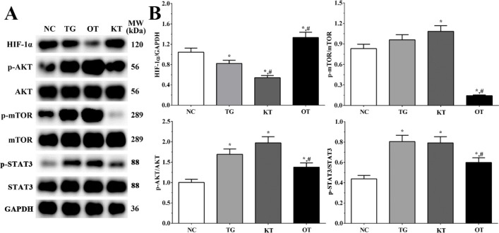 Effect of taxifolin on activation of PI3K/AKT/mTOR/STAT3 signaling pathway of cardiomyocytes. (A) Western blotting analysis of PI3K/AKT/mTOR/STAT3 signaling pathway. (B) Quantitative analysis of PI3K/AKT/mTOR/STAT3 signaling pathway. *P < 0.05 vs. NC group, #P < 0.05 vs. TG group. Data was presented as a mean ± SD. Each experiment was repeated for three times independently