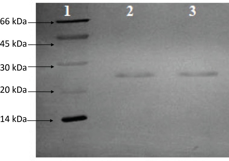 SDS-PAGE analysis of purified HBsAg. Thegel was stained with silver nitrate. Lane 2 and.3 purified bulk of HBsAg, Lane 1. Low molecular weight calibration kit (14.4-97KDa, GE Healthcare), Lane 3.Diluted (1:2) purified HBsAg bulk.