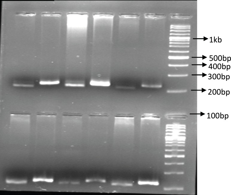 The PCR-RFPL analysis of UGT1A9 T-275A SNP in patients. The DNA from patients was subjected to PCR followed by RFPL using XbaI digest. The reactions were resolved on 2% agarose gel electrophoresis. Lanes 1-3 and 4-6 are from two different patient hetrozygote for T-275A SNP. Lane 1, 4 are PCR products and lane 2, 3 and 5, 6 are XbaI digest of corresponding samples. The reactions were compared to 100 bp DNA ladder. (PCR-RFLP :poly chain reaction-restricted fragment length polymorphism, UGT: Uridine diphosphate glucuronosyl transferase, SNP: Single nucleotide polymorphism).