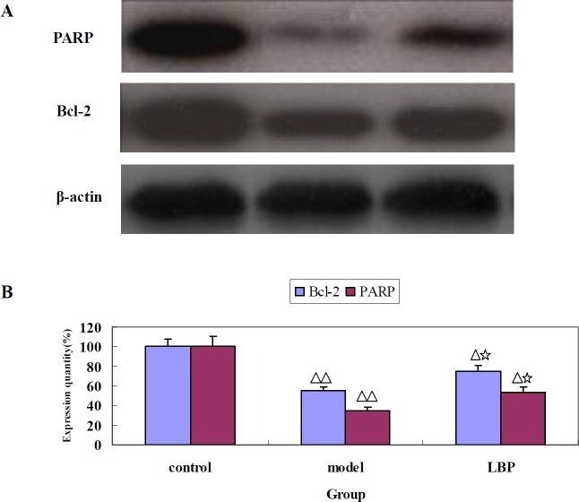The effect of LBP on the expression of Bcl-2 and PARP in mice striatum. (A) Representative images of Bcl-2 and PARP protein expression detected by western blot. β-actin was used as a control. (B) Quantification of the Bcl-2 and PARP expression. Data are expressed as mean ± SD. from 3 independent experiments. Compared with control, ΔP < 0.05, ΔΔP < 0.01; Compared with model