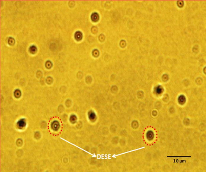 Light Microscope Image of double-emulsion solvent evaporation (W1/O/W2).