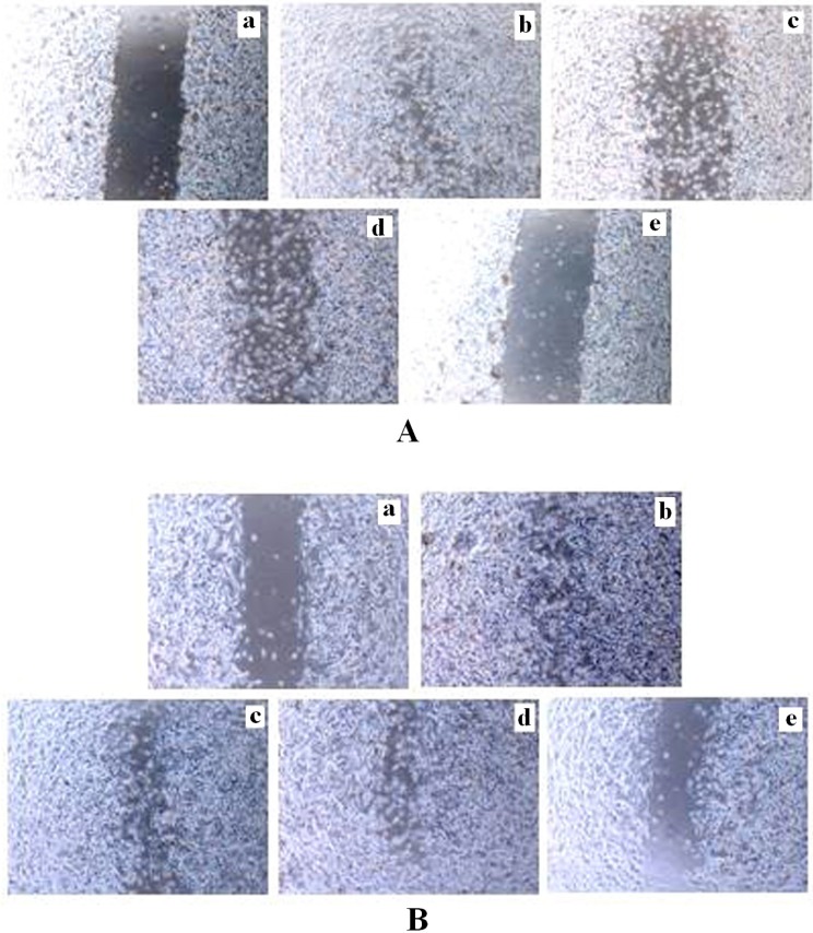 Inhibition of invasion in monolayer wound healing model induced by TAM and TRAN or in combination alone on MCF-7(A) and MDA-MB-231(B) cells. Phase micrographs of cells were taken at various times after monolayer wounding. a The control group in 0 day; b The control group after 48 h; c cells treated with 2 µM TAM ; d cells treated with 200 µM TRAN ; e cells treated with combination