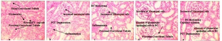 Comparison of the nephrotoxic effects between AgNo3 and Ag NPs in treated animals detected by H&E staining (10x). a: Negative control shows BC (Bowman's capsule) DCT ( Distal Convoluted Tubule), PCT ( Proximal convoluted tubule) and GL (Glomerulus) b: AgNO3 treated kidney shows Capillary dilation, PCT degeneration and inflammatory responses, c: Low dose Ag NPs treated kidney shows Inflammation, Adhesion of glomerular epithelial cells to BC, BC thickening, PCT Degeneration and increased Mesangial cells, d: Medium dose Ag NPs treated kidney shows Inflammation, Adhesion of glomerular epithelial cells to BC, BC thickening, PCT Degeneration and increased Mesangial cells e: High dose Ag NPs treated kidney shows the same but more severe toxic effects
