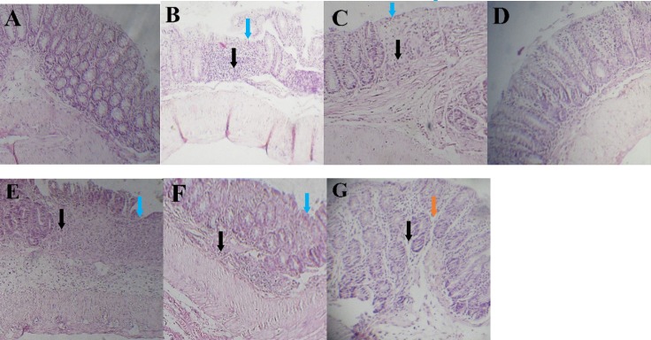 Histopathological appearance of colon sections stained by H&E technique. (A) Sham group, (B and C) Inflamed mucosa in colitis control and L-glutamic acid (2 g/kg) treated groups, respectively. It is associated with mucosal layers destruction, submucosal edema (brown arrows), severely damaged crypt, loss of epithelium (blue arrows) and leukocyte infiltration (black arrows). (d) dexamethasone (1mg/kg, i.p.), (e) dizocilpine 0.1 mg/kg, (f) dizocilpine 1 mg/kg (g) dizocilpine 5 mg/kg (i.p.) improved the extent and severity of the histopathological changes of colitis including inflammation cell infiltration and crypt damages