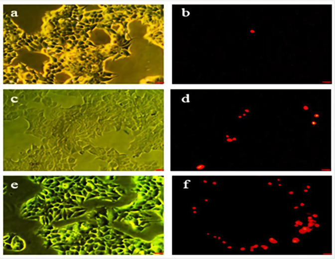 Phase contrast and fluorescent images of treated and non treated MCF-7 cell line. (a and b) the control group, (c and d) cells which pure Hydroxyurea was added in their culture medium. (e and f) cells which nanoparticles-loaded Hydroxyurea was added in their culture medium. Scale bar = 100 µm
