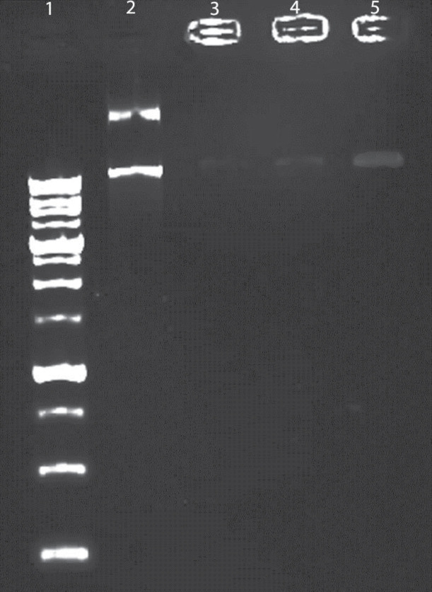 Binding, protection, and DNase-induced release of DNA from niosomes visualized by agarose electrophoresis.; lane 1, ladder; Lane 2 correspond to free DNA; lane 3 Nio/CTAB5%/Fe/P; lane 4; Nio/CTAB3%/Fe/P and lane 5; Nio/Fe/P