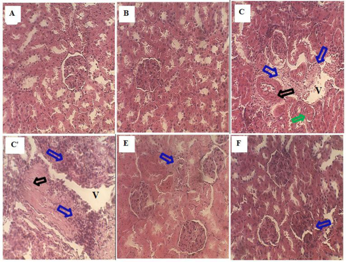 (A, ×40). The histological examination of the kidney from the control rat showed normal architecture. (B, ×40) The kidney section of A. halimus treated rats showed a healthy renal architecture. (C, C', ×40) Sodium benzoate treated rats' kidneys showed a Focus of inflammation (blue arrow), Glomerular necrosis (black arrow), Glomerular atrophy (green arrow) and vacuolation (V). Ah curative treated rat kidney showed a normal appearance of tubule and glomerulus and few inflammatory cellular infiltrations (blue arrow) (E, ×40). (F, ×40) Kidney sections of sodium benzoate rats prevented by A. halimus showed a moderate degree of kidney damage inflammatory cell, protection from tubule and glomerulus degradation