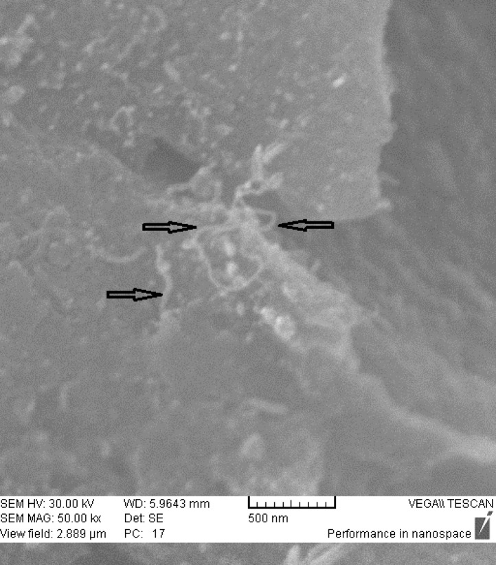 SEM images of dcd-SWCNT.