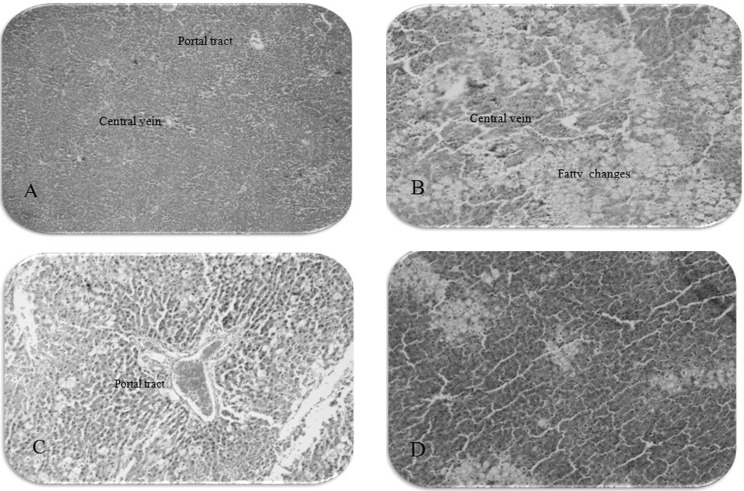 The photomicrographs of liver section from rats: (A) normal control group (10 × 4), (B) received CCl4: liquid paraffin (10 × 10), (C) received Legalon + CCl4 (10 × 10), (D) received extract 300 mg/Kg + CCl4 (10 × 10