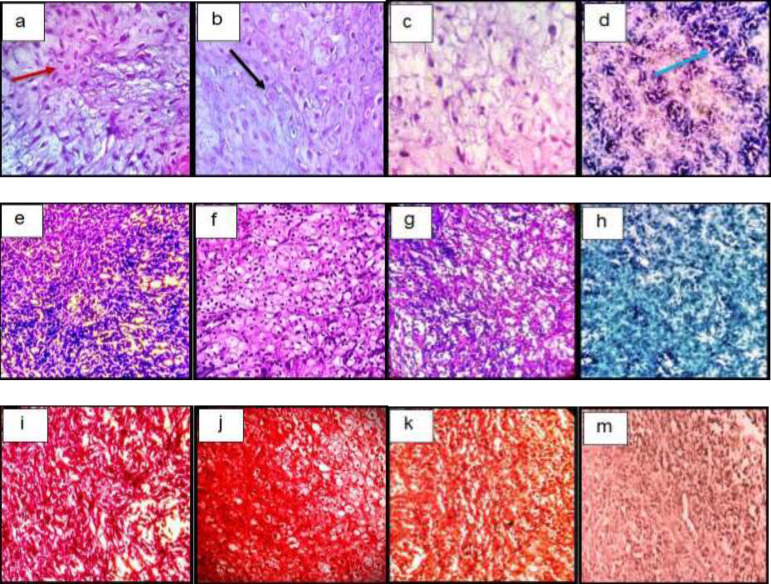 Histological sections of neo-cartilage formed by TGF-β3, KGN and ASU in fibrin scaffold cultures after 14 days as determined by H&E (a: TGF-β3, b: KGN, c: ASU and d: Control), Toluidine blue (e: TGF-β3, f: KGN, g: ASU and h: Control), Safranin O (i: TGF-β3, j: KGN, k: ASU and m: Control) in the rat model, magnification ×40. Blue arrow: Stem cell with an elongated and fusiform nucleus. Red arrow: Extracellular matrix. Black Arrow: Chondrocytes-like cells inside the lacunae