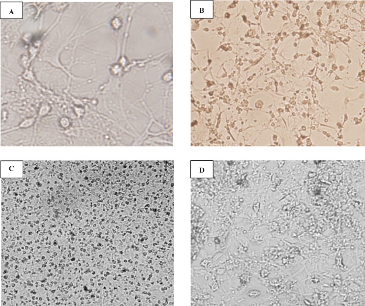 Morphological studies of cerebellar granule cells culture The effect of the age of cultures and rats on the morphological studies on CGN-cultured