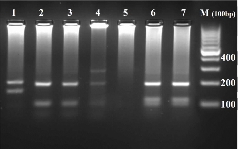 Agarose gel electrophoresis, showing PCR-RFLP results. Lane 1: Leishmania major; lanes 2-4: L. tropica; lane 5: negative control; lanes 6 and 7: L. infantum; M: molecular weight marker