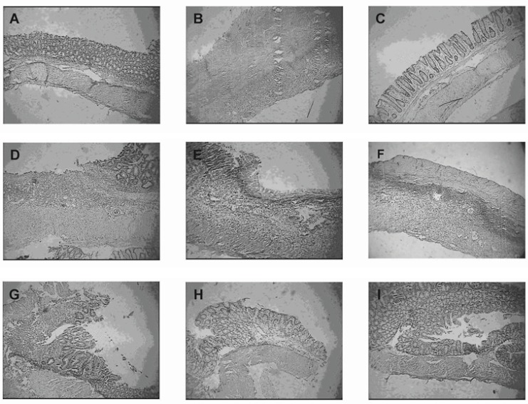 Representative photographs of histological appearance of rat colonic mucosa. A= Normal control group, B= Colitis control group, after exposure to TNBS (100 mg/kg) the colon is markedly inflamed, the mucosal wall is thickened, and there is a transmural inflammatory cell infiltration. C= Budesonide pectin/Surelease coated pellet (300 μg/kg/day) group, D= Budesonide solution group (300 μg/kg/day), E=Budesonide uncoated pellet group (300 μg/kg/day), F= Placebo pellet group, G= Mesalazine enema (400 mg / kg/day, rectally) group, H= Budesonide enema (20 mcg/kg/day, rectally) group and I= Prednisolone (5 mg /kg /day, oral) group. Hematoxylin and eosin stain with original magnification 10×.