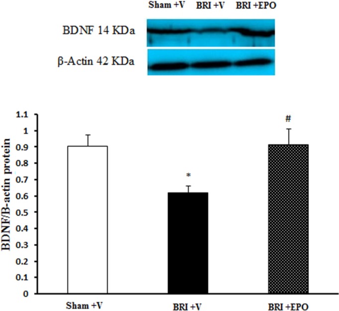 The Effect of BRI and EPO on the BDNF protein levels in the hippocampus of rats. BRI + V decreased the BDNF protein levels in the hippocampus of rats. Meanwhile EPO improved this deficit. Each value point in the graphs represents the mean ± S.E.M (5 rats/group). β-Actin was used as an internal control. *P < 0.05 as compared to sham group, #P < 0.05 as compared to BRI + V group