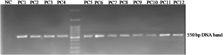 Agarose gel electrophoresis of the displayed peptide-encoding DNA insert obtained from selected phagesAn approximately 550 bp fragment is amplified by PCR on the isolated phage genomes. PC1 to PC12: Phage plaques selected from the third round of panning, NC: negative control.