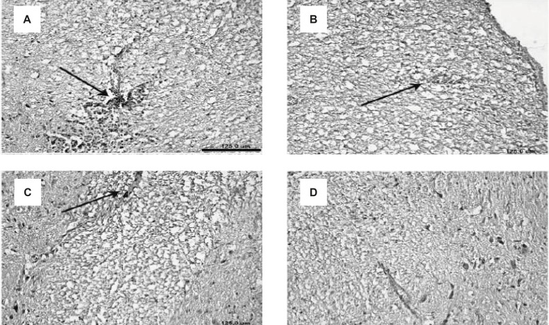 Decreased demyelination of the CNS in EAE rats, induced by GPSCH-CFA, after the treatment with Bee venom. A-D displays the slices of spinal cord and their demyelination process within different experimental groups: (A) E-S group, (B) E-BV1 group, (C) E-BV2 group and (D) Control group (Scale bar A-D = 125 µm).