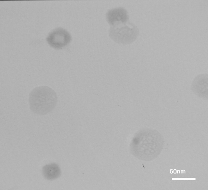 TEM images of AS-NL