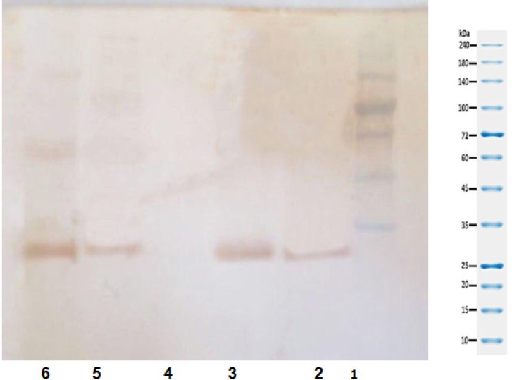 Confirmation of gene expression by western blot
