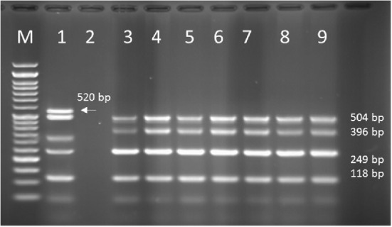 PCR products of Multiplex PCR results on DNA isolated from human on 1.5 % agarose gel electrophoresis showed specific bands of OPRL (504bp), OPRI (249 bp), ALGD (520 bp), Exo-S (118 bp), and EXT-A (396 bp) in comparison with DNA ladder.