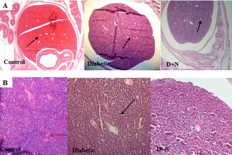 Effects of Nanoceria on diabetic induced pathological changes in liver of mice embryo