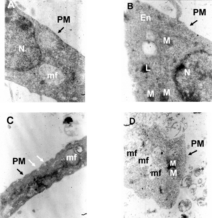 TEM images of cultured hippocampal pyramidal neurons in different experimental conditions. (A) Electron micrographs of a neuronal soma in the control condition, (B) following treatment with Aβ alone, (C) following Aβ plus rosiglitazone and (D) Aβ plus FH535. Images are from a 14 days old culture. N: Nucleus; M: Mitochondria; PM: Plasma Membrane; L: lysosome; mf: myelin figure; ER: Endoplasmic reticulum; En: Endosome vesicles; White arrows indicate endocytotic membrane invagination. 20000X magnification