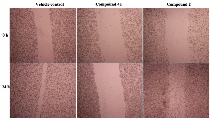 Effects of compounds 2 and 4a on cell migration by wound healing assay (25μmol/L). Upper panel: Vehicle, 4a and 2 groups at 0-h time point. Bottom panel: Vehicle, 4a and 2 groups at 24-h time point