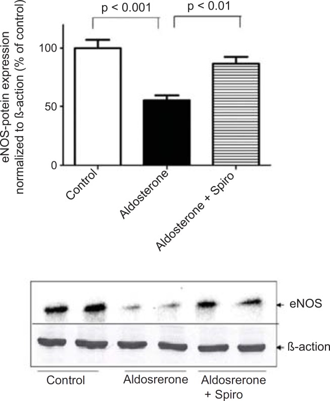 Effects of aldosterone (100 nmol/L) on eNOS protein levels in HUAECs incubated for 24 h in the absence or presence of spiro (1µmol/L). Aldosterone attenuated eNOS protein expression and spiro (1µmol/L) restored in to the normal level ; was normalized with B-actin, by scanning densitometry. Values for each bar are mean ± SEM from 4 separate experiments and expressed as % of control, p < 0.001 of aldosterone versus control and p < 0.01 spiro versus aldosterone. Spiro: Spironolactone; eNOS: Endothelial nitric oxide synthase.