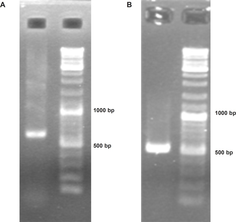 Confirmation of soluble human TRAIL PCR products using electrophoresis on 2% Agarose gel. Panel (A) represents obtaining “a 620 bp fragment” from extracellular domain of TRAIL through specific RT-PCR. Panel (B) represents obtaining a 504 bp band encoding soluble human TRAIL through nested PCR.