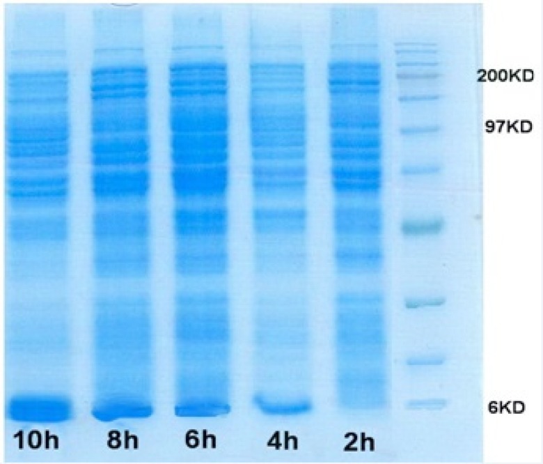 SDS-PAGE gel of rhIGF-1 expression in Fermentor experiment