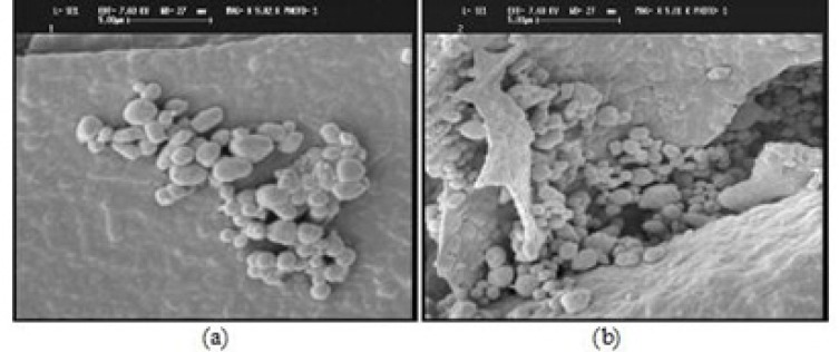 SEM images of a) yeast cells and b) berberine loaded yeast cells