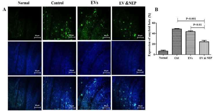 The effect of intranasal EV-loaded NEP administration on beta-amyloid plaques accumulation. (A) Representative micrographs of immunofluorescence staining of beta-amyloid proteins in Normal, Control, EVs, and EV-loaded NEP groups, Scale bar: 50μm. Cell nuclei were counterstained with DAPI and (B) Expression percentage of Aβ plaques, significantly decreased in EV-loaded NEP group was observed in comparison to control (p < 0.001) and EVs (p < 0.01) groups after 14 days treatment. Images were represented from at least 3 sections per animal in each experimental group after 14 days treatment; (n = 4 in each group, the results were quantified with ImageJ software and the differences between groups were determined by ANOVA followed by Tukey test). Defined groups are Normal, Ctrl: received PBS, EVs: received EVs, EV&NEP: received EV-loaded NEP in the treatment period