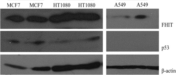 Western blot analysis of endogenous FHIT (with Abcam Anti-FHIT) and p53 expression in HT1080 and A549 cell lines. MCF7 was used as high expressing cells and β-actin was used as internal control