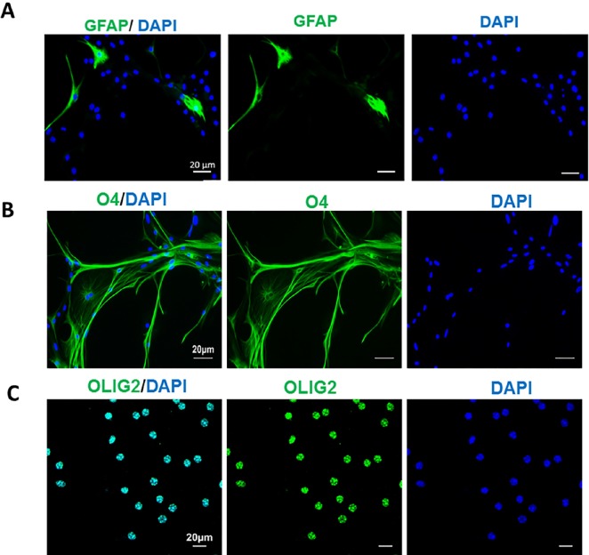 Conversion the fate of TSA-treated mouse astrocytes to oligodendrocyte progenitors. The induced cells were nearly negative for GFAP as an astrocyte marker (A) but expressed O4 (B) and Olig2 (C) as oligodendrocyte progenitor markers at 27 days post induction. Scale bar: 50 μm
