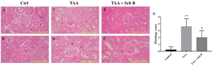 Histopathology of the kidney. (A and B) Two representative photomicrographs of H&E-stained kidney sections from control mice. (C and D) Kidney sections from TAA-injected mice. Degeneration of renal tubular (yellow asterisks) and desquamation (blue asterisks) were seen. (E and F) Kidney sections from TAA-injected mice following Sch B treatment. Fewer tubular degeneration and desquamation were seen. Images are shown at 100× magnifications; scale bars, 200 μm. G, glomeruli; P, proximal convoluted tubules; D, distal convoluted tubules. (G) Histology score of kidney sections, presented as mean ± SD (n = 5). ***P-value < 0.001 compared with control; #P-value < 0.05 compared with TAA