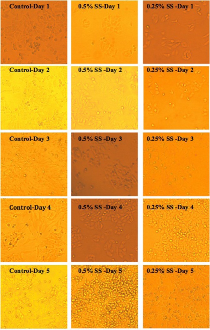 Morphological study on A549 cell line, following exposure to 10% serum (control), and starved stated at 0.5% and 0.25% serum. In the images below, SS indicates “Serum Starvation”.