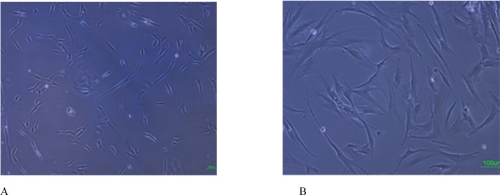 Isolation and culture of human bone marrow derived MSCs. A: Adherent monolayer was achieved in the following 6-7 days; B: As the culture proceeded, the cells were both small spindle, and wide-shaped morphology. Scale bar for Figures A-B: 100 µm