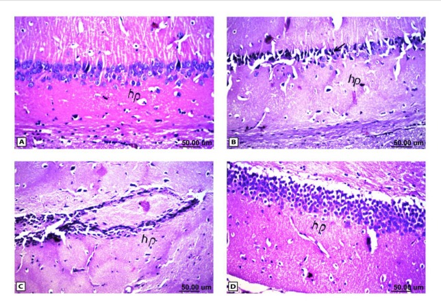 Histopathological results of rat brain area hippocampus (hp). (A) Normal control group: normal structure of the hippocampus (hp). (B & C) Rat administered AlCl3: neuronal degeneration and pyknosis (arrow) in hippocampus (hp) & atrophy hippocampus. (D) Rat treated with i.v. nano-HAp after AlCl3: normal structure of the hippocampus (hp)