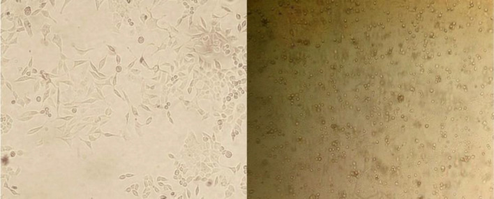 Morphological changes in AGS cells after treatment with IC50 dose of Hypericin for 24 h. Left, untreated AGS cells; right, exactly same cells after 24 h treatment by Hypericin (magnification 100X).