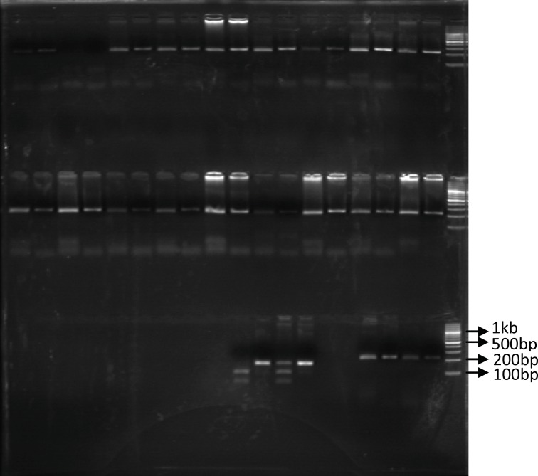 The PCR-RFPL analysis of UGT 1A9*3 T-275A SNP in patients. The DNA from patients was subjected to PCR followed by RFPL using StyI digest. The reactions were resolved on 3% agarose gel electrophoresis. Lanes 1-2 and 3-4 are from two different patients. Lane 1, 3 are PCR products and lane 2 and 3 are StyI digest of corresponding samples. Lane 2 indicates presence of UGT1A9*3 SNP (mut) and Lane 4 indicate wild type UGT1A9 (WT). The reactions were compared to 100bp DNA ladder. (PCR-RFLP: poly chain reaction-restricted fragment length polymorphism, UGT: Uridine diphosphate glucuronosyl transferase, SNP: Single nucleotide polymorphism).