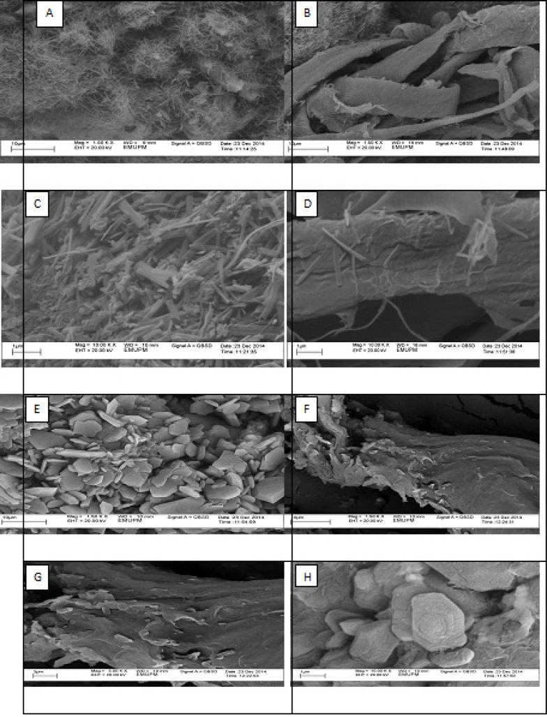 The SEM micrographs for chitin (A, B, C, D) and chitosan (E, F, G, H