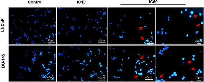 Fluorescent staining of nuclei of calycopterin-treated LNCaP and DU-145 cells by Hoechst dye. Cells were treated with IC10 and IC50 concentrations of calycopterin. Apoptotic nuclei are indicated by red arrows