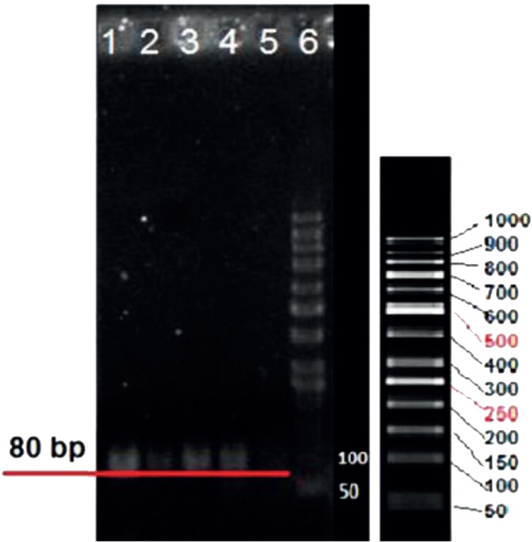 Agarose gel electrophoresis showing colony PCR product of selected aptamers with high affinity to LNCaP cells. Lanes 1-5 belong to 80 bp cloned selected aptamers. Lane 6 belongs to 50 bp ladder
