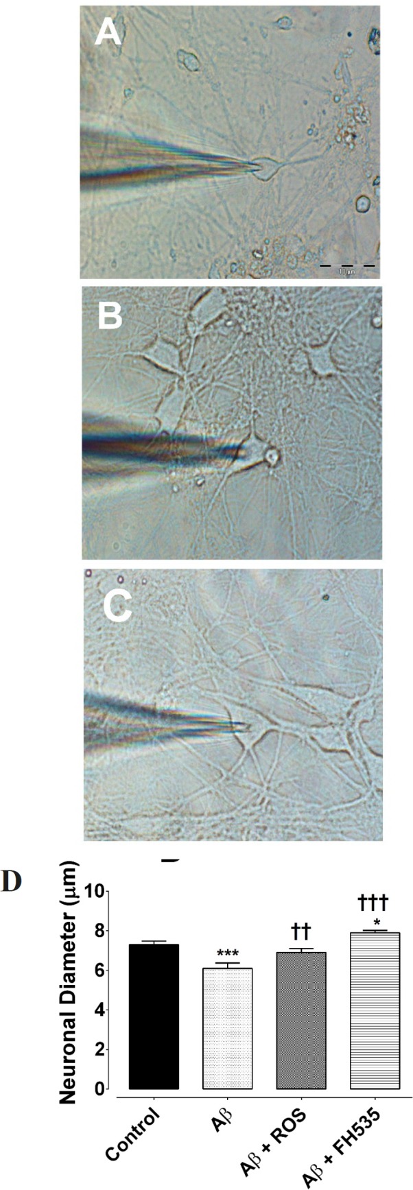 Hippocampal pyramidal neurons cultured in Neurobasal/B27 medium. (A) Primary cultured neurons were photographed at DIV 14 in control, (B) following 24 h exposure to Aβ, (C) after treatment with either Aβ + rosiglitazone or (D) Aβ + FH535 for 24 h. The histogram indicates the neuronal diameter in different conditions. Exposure to Aβ led to a significant decrease in neuronal soma size. Activation of PPR-γ by rosiglitazone preserved the cell soma size in the presence of Aβ, but exposure to FH535 did not prevent the effect of Aβ on cell soma size. *indicates P < 0.05, ***indicates P < 0.001 versus control neurons, †† and ††† indicate P < 0.01, P <0.001 versus Aβ alone-treated neurons