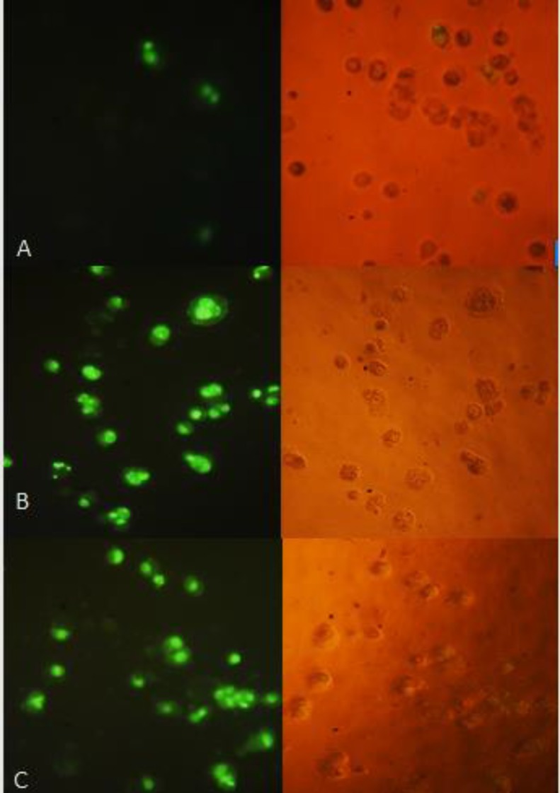 TUNEL assay: HT-29 cells were treated with 40 µg/mL of (A) control (B) CM (C) CF. The right side figure remarks the light microscope view and the left side remarks fluorescent view of the same field. The level of staining indicates the degree of DNA damage induced by treatment, where more positively stained cells are in the final stages of apoptosis. Magnification: 200 ×.
