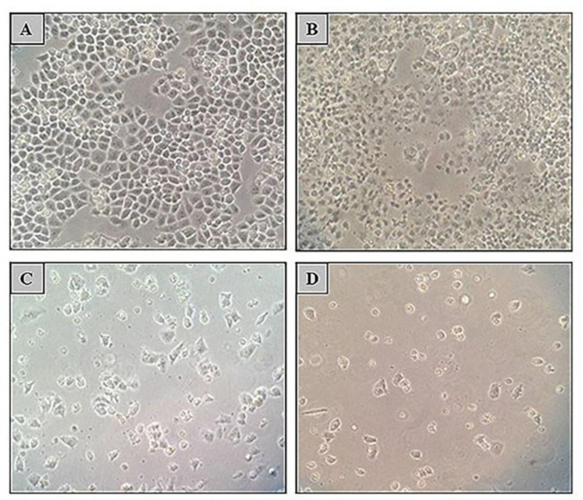 Effect of TSA, 5-Aza, and cisplatin alone or in combination on cell survival and morphology of A2780CP cell line. Morphology of A2780CP cells was observed using an optical inverted microscope (magnification, 10X). A) Treatment with 10 µM cisplatin could not inhibit A2780CP cells growth (96% cell viability) whereas; B) 48 h treatment with 5-Aza (5 µM); C) 72 h treatment with 5-Aza (5 µM) and; D) 48 h co-treatment with 5-Aza (5 µM) and TSA (0.5 µM) following 48 h with cisplatin could result in growth inhibition (65%, 33% and 12% cell viability; recpectively).